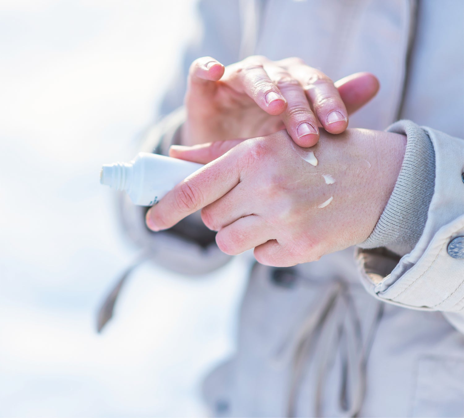 Man applying cream to eczema on hands