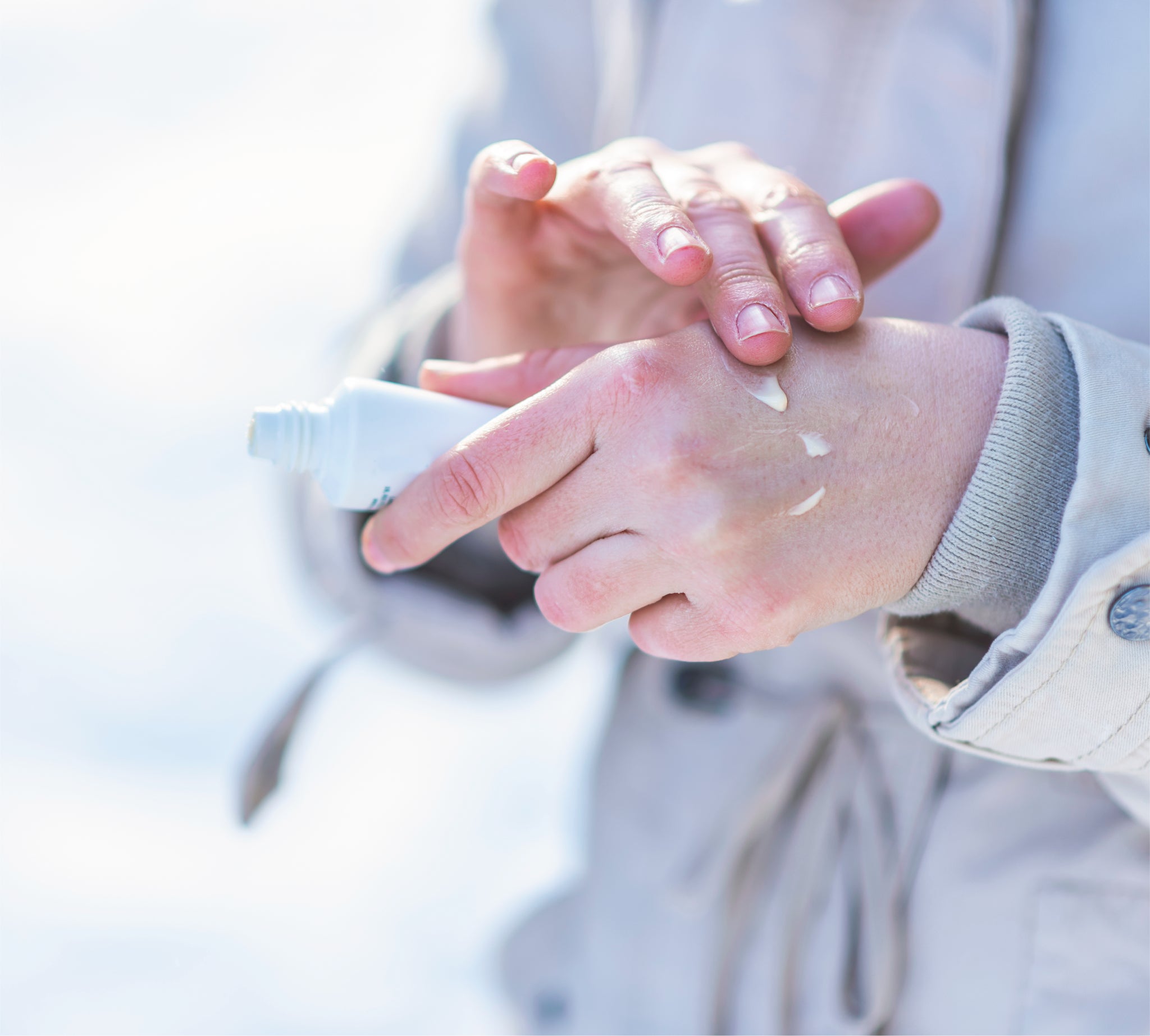 Man applying cream to eczema on hands